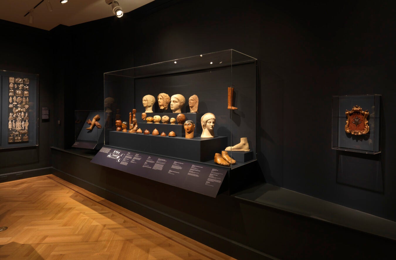 A museum display against dark walls featuring sculpted heads, limbs, and anatomical models arranged in a glass case. The objects range from realistic to stylized and are made from materials like plaster and wood. Informational labels are mounted below the display.