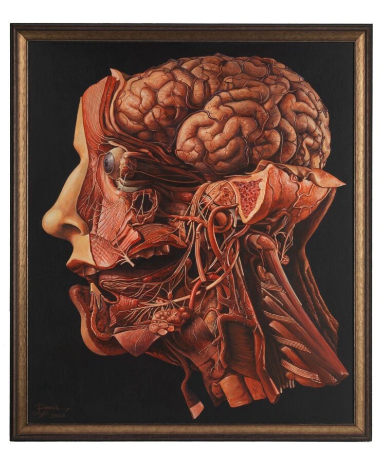 A highly detailed acrylic painting of a dissected human head, revealing the complex anatomy of the brain, muscles, blood vessels, and nerves. The left half of the face remains intact, showing a natural human profile, while the right side is meticulously exposed to display underlying structures. The painting, created in 2001 by artist Richard Ennis, serves as a memorial to a friend who passed away from squamous cell carcinoma. It blends anatomical precision with artistic tribute, drawing inspiration from wax models at La Specola in Florence.