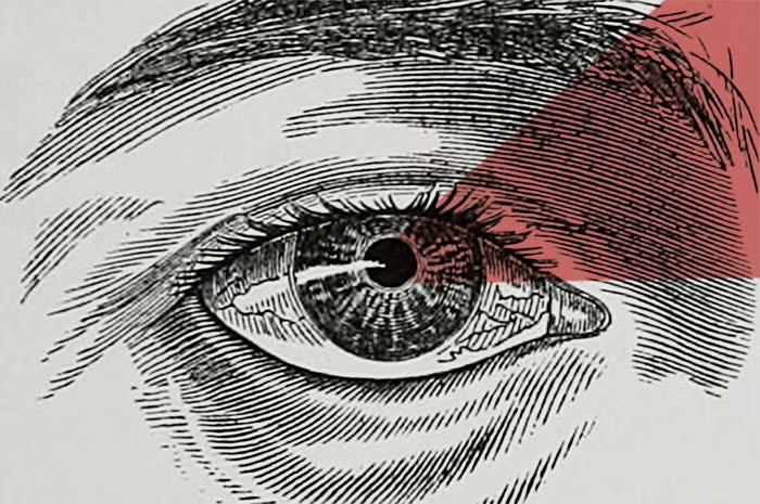 Black-and-white engraved illustration of a human eye, with a translucent red triangular overlay covering the upper-right area around the eyelid and eyebrow.
